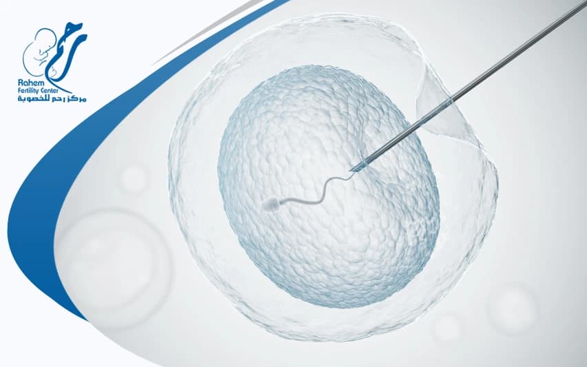 Intracytoplasmic Sperm Injection