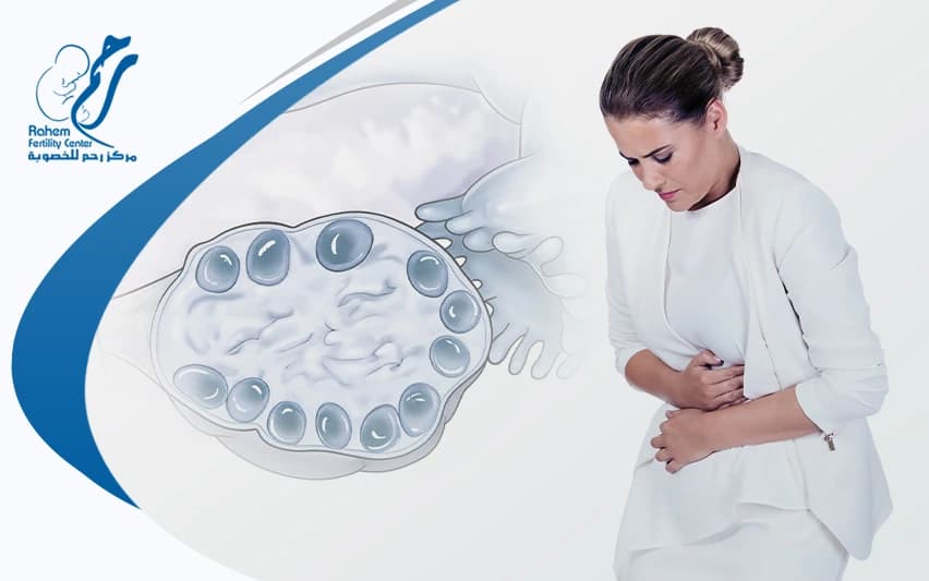 Polycystic Ovary Syndrome Treatment