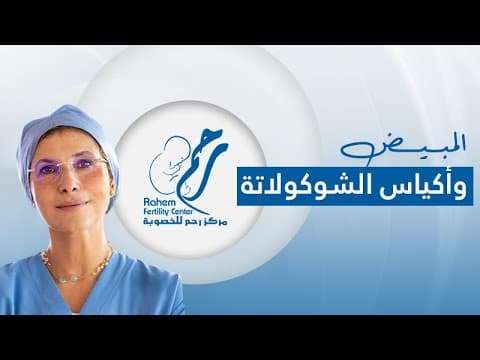 أكياس الشوكولاتة على المبيض وفرص الحمل | هل تؤثر على الحمل ومخزون المبيض؟
