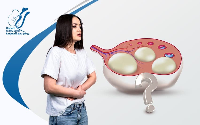 أسباب تكيس المبايض عند المتزوجات