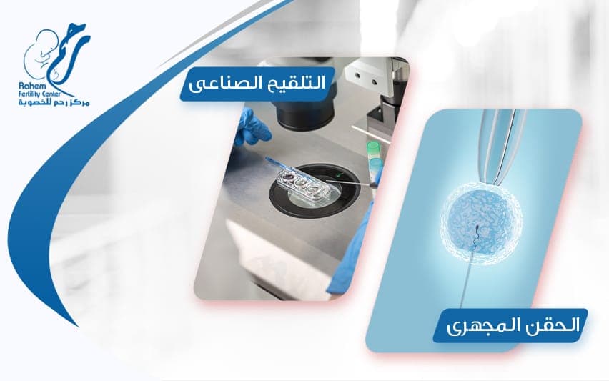 الحقن المجهرى والتلقيح الصناعى