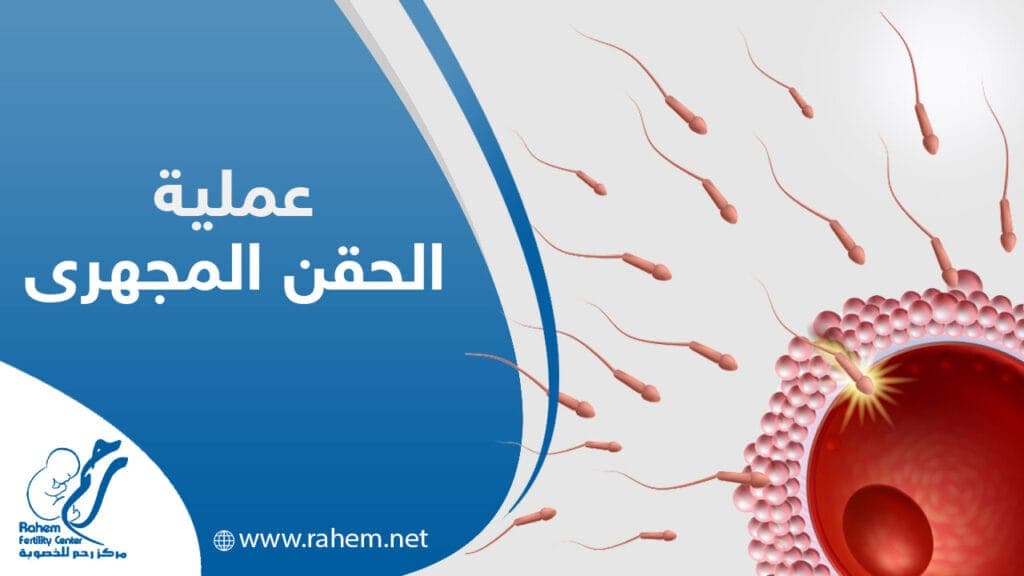 الحويانات المنوية تلقح البويضة اثناء الحقن المجهري