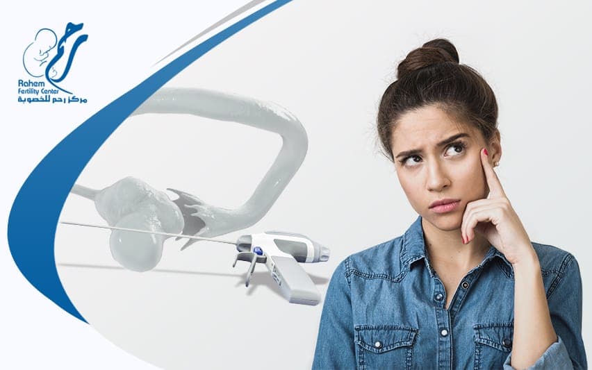 نسبة الحمل بعد عملية المنظار لتكيس المبايض|نسبة الحمل بعد عملية المنظار لتكيس المبايض