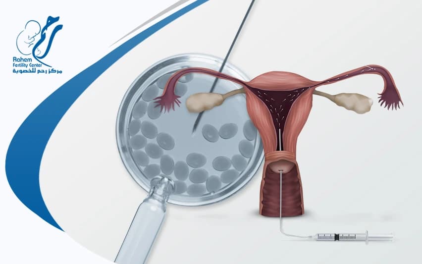 IUI or IVF