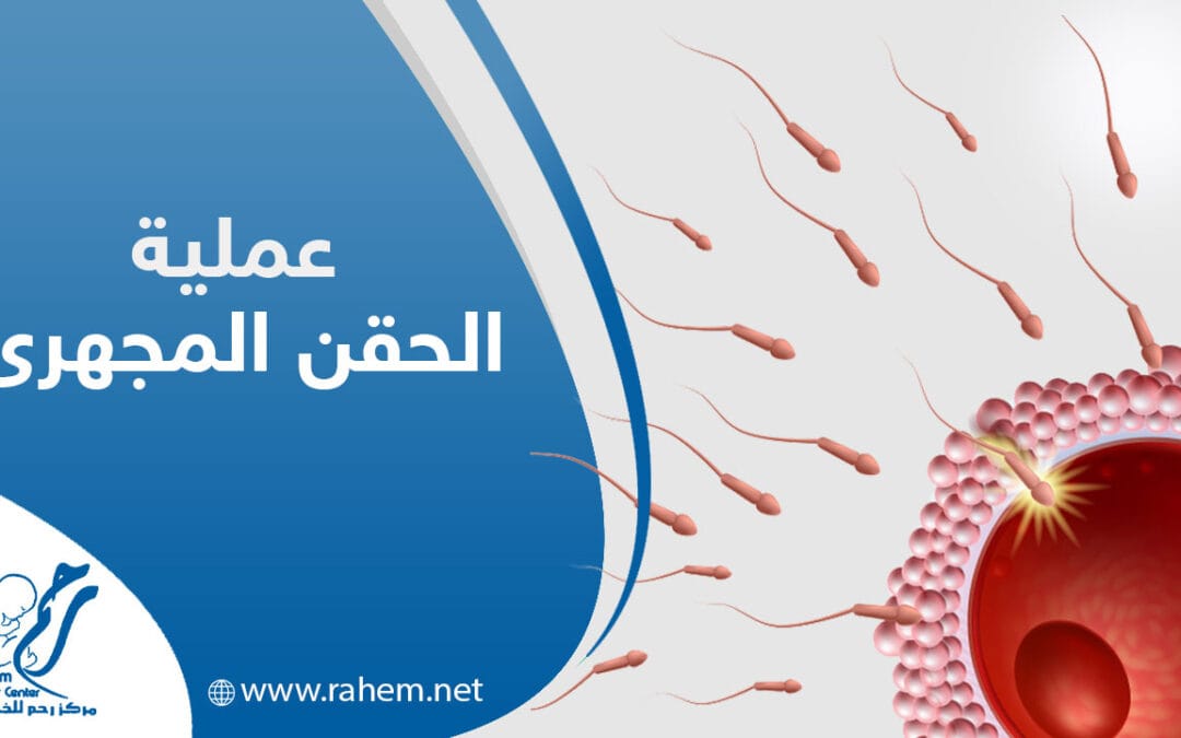 الحقن المجهري