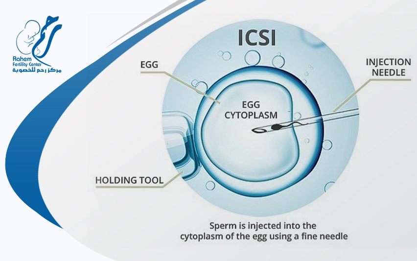 how does intracytoplasmic sperm injection work